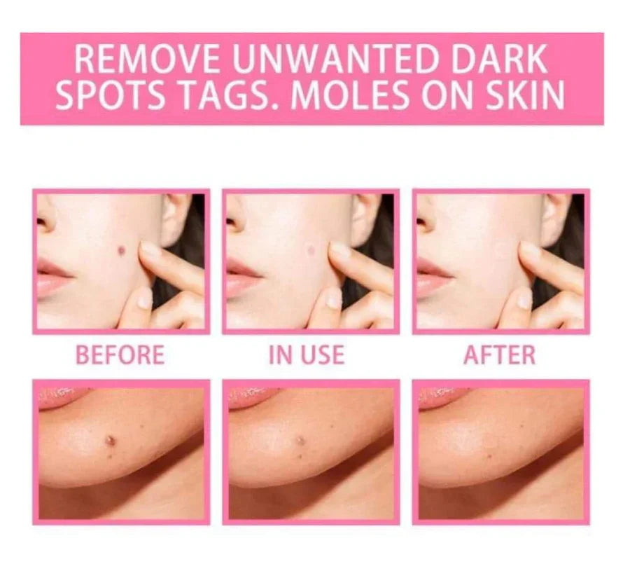 NATURAL SPOTS FREE SERUM