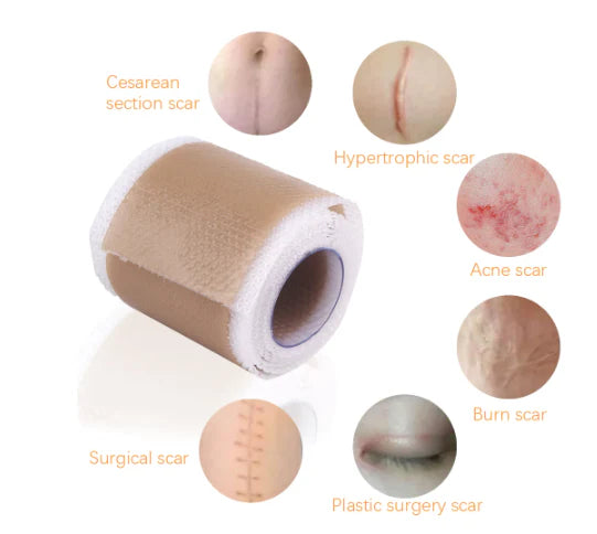 SILICONE SCAR TAPE
