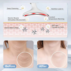 EMS Facial Massager