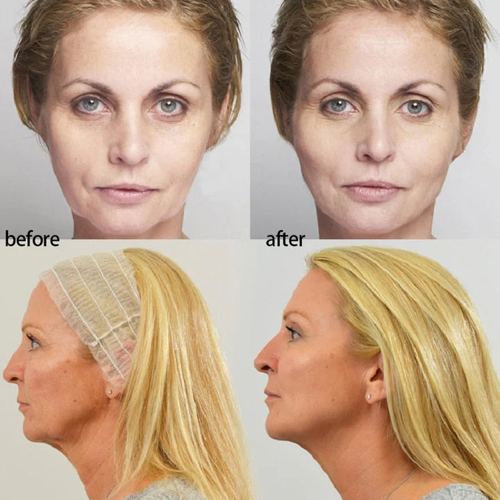 Collagen Thread With 24K Gold Serum