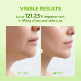 V-Shape Lifting Mask Peptides & Collagen