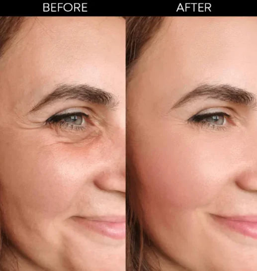 Collagen Thread With 24K Gold Serum