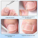 Toenail Correction Strips