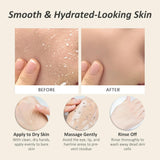 Derma exfoliating cream