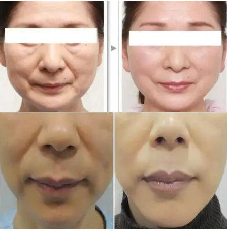 Collagen Thread With 24K Gold Serum