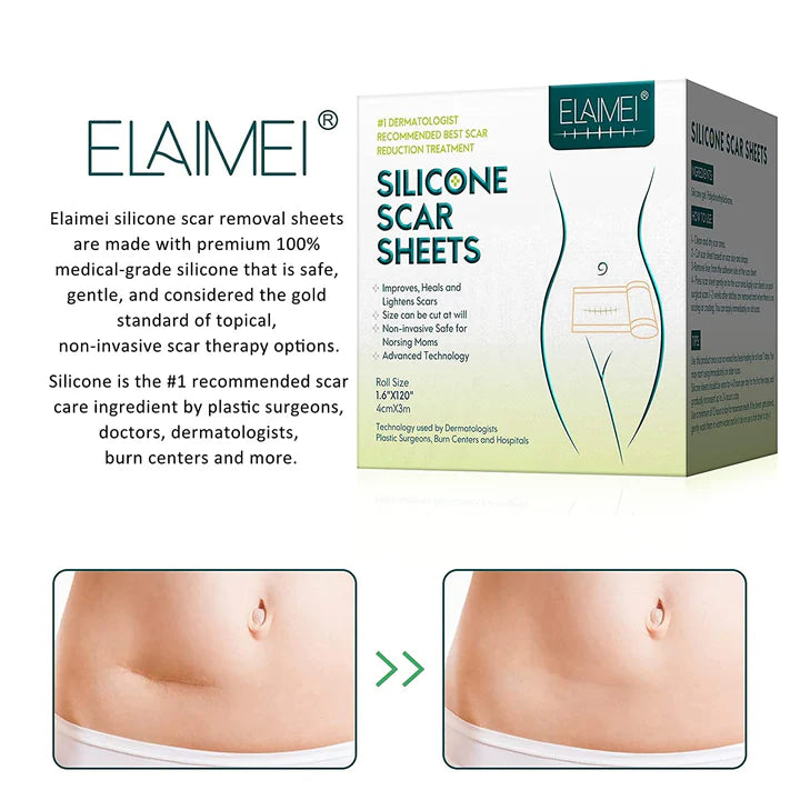 SILICONE SCAR TAPE