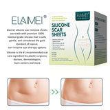 SILICONE SCAR TAPE