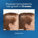 Advanced Hair Growth Roll-On Essence Oil