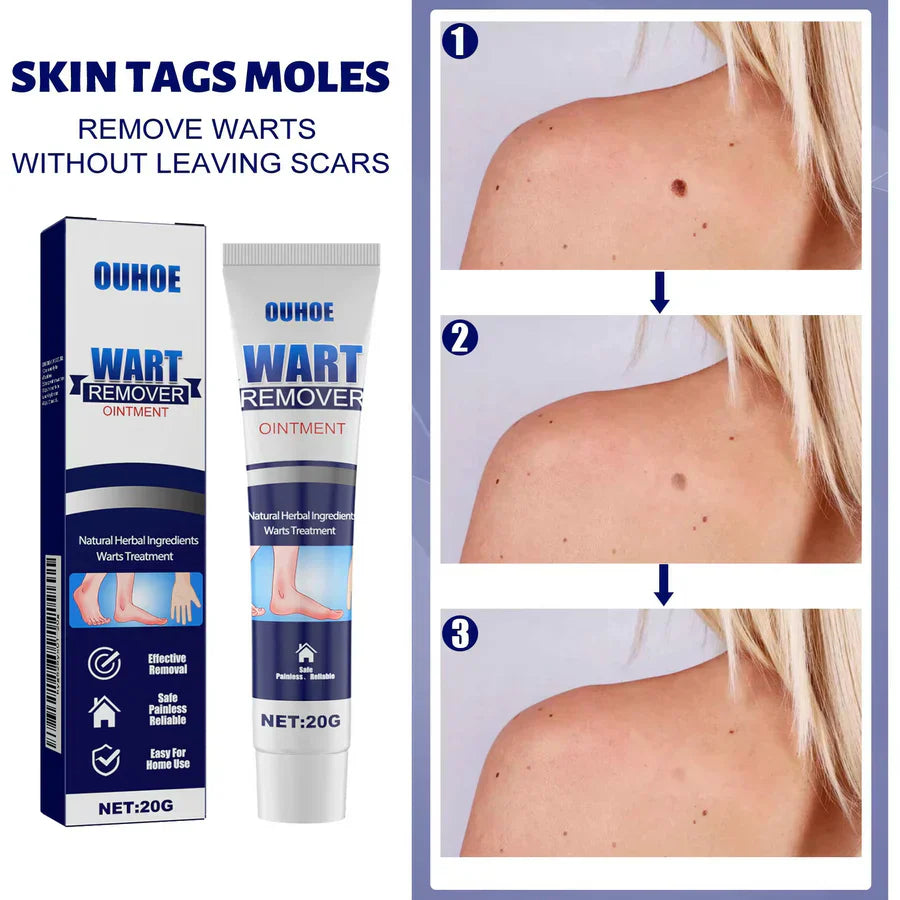 WartAway Herbal Cream