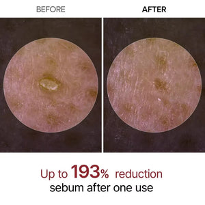 GlowRice™ Peel Shot