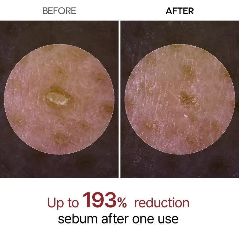 GlowRice™ Peel Shot