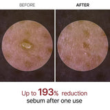 GlowRice™ Peel Shot