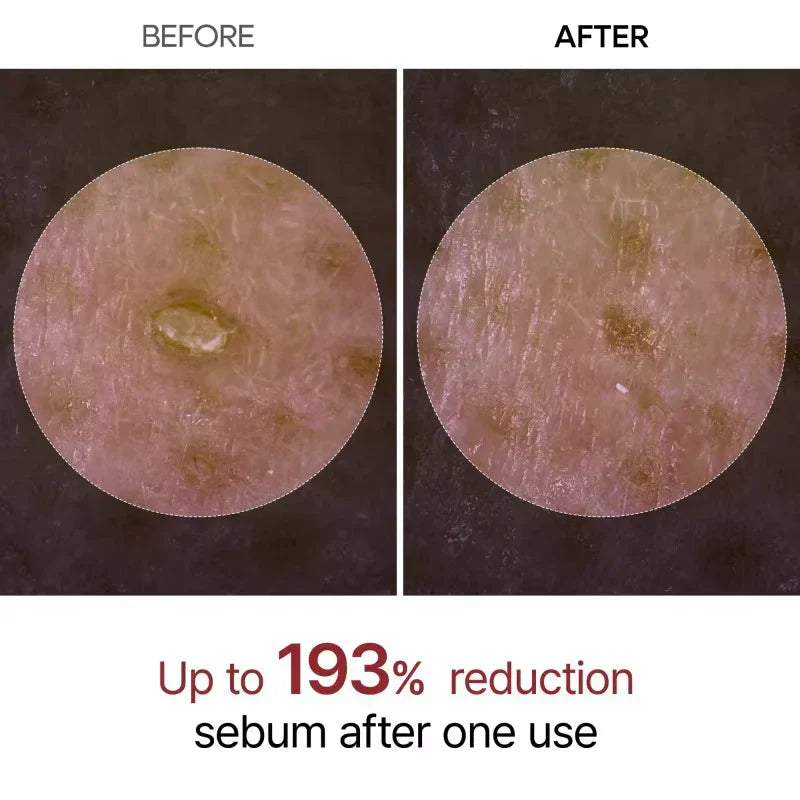 GlowRice™ Peel Shot