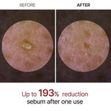 GlowRice™ Peel Shot
