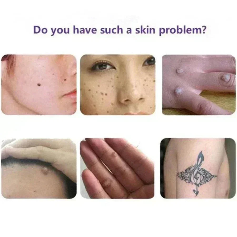 NATURAL SPOTS FREE SERUM
