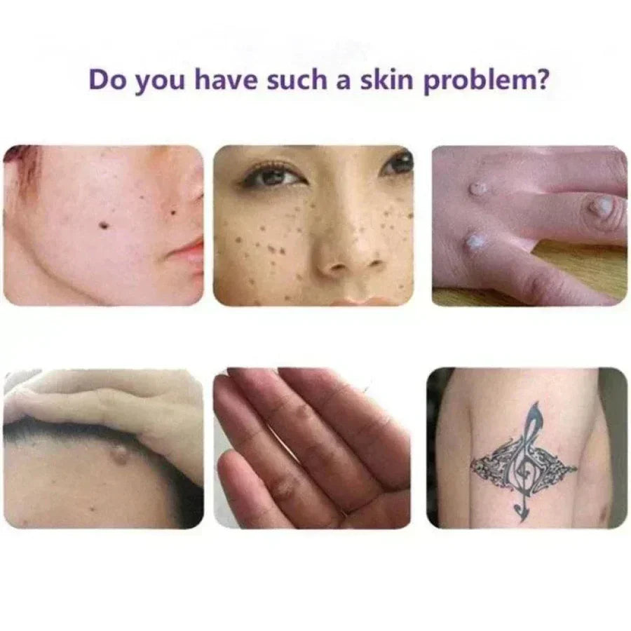 NATURAL SPOTS FREE SERUM