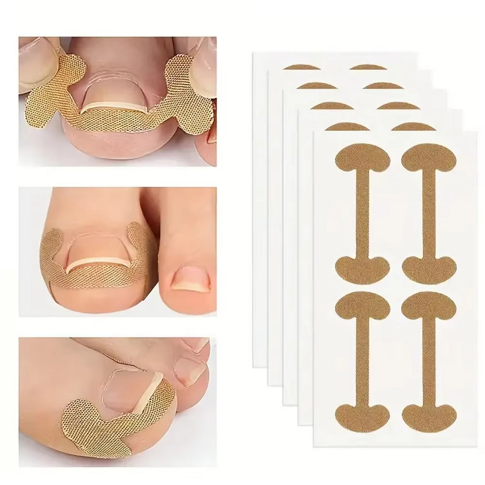 Toenail Correction Strips
