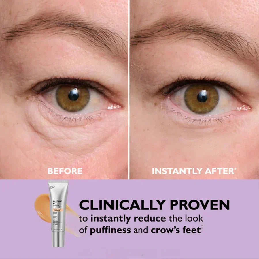 Instant Eye Tightener