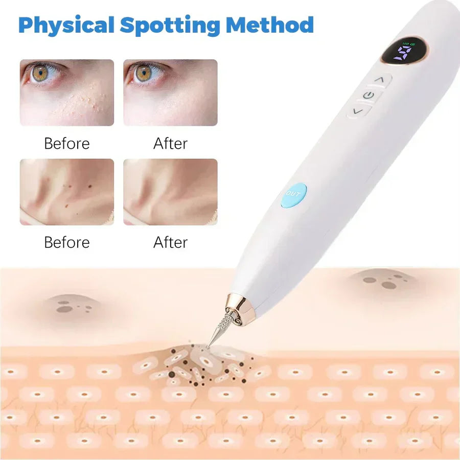 MoleAway Pro
