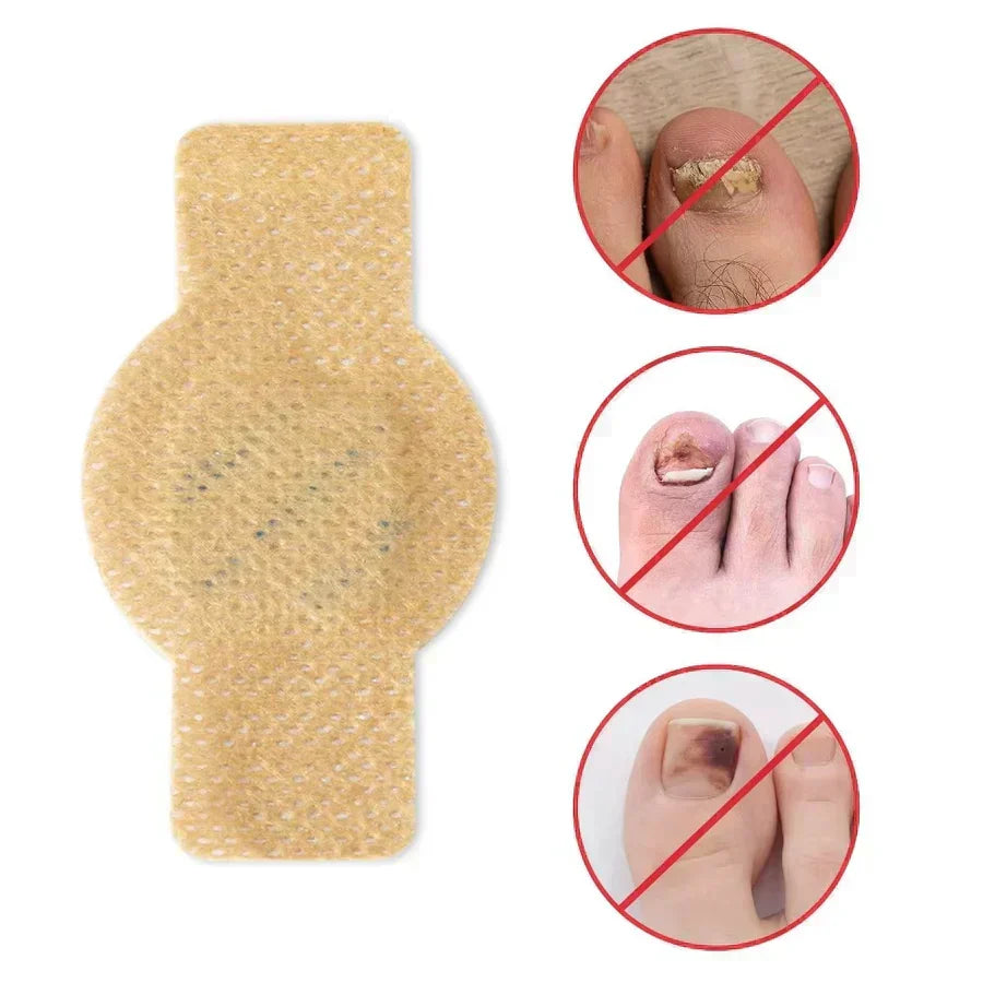 #1 Parches para hongos en las uñas
