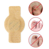 #1 Parches para hongos en las uñas