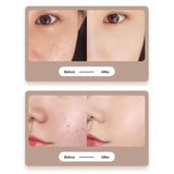 MoleAway Pro