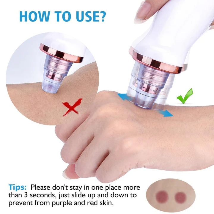PORE VACUUM BLACKHEAD REMOVER