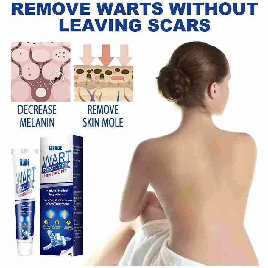 WartAway Herbal Cream