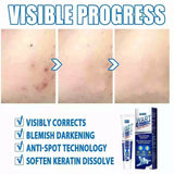 WartAway Herbal Cream