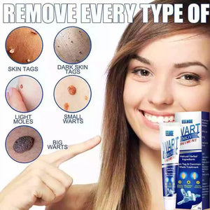WartAway Herbal Cream