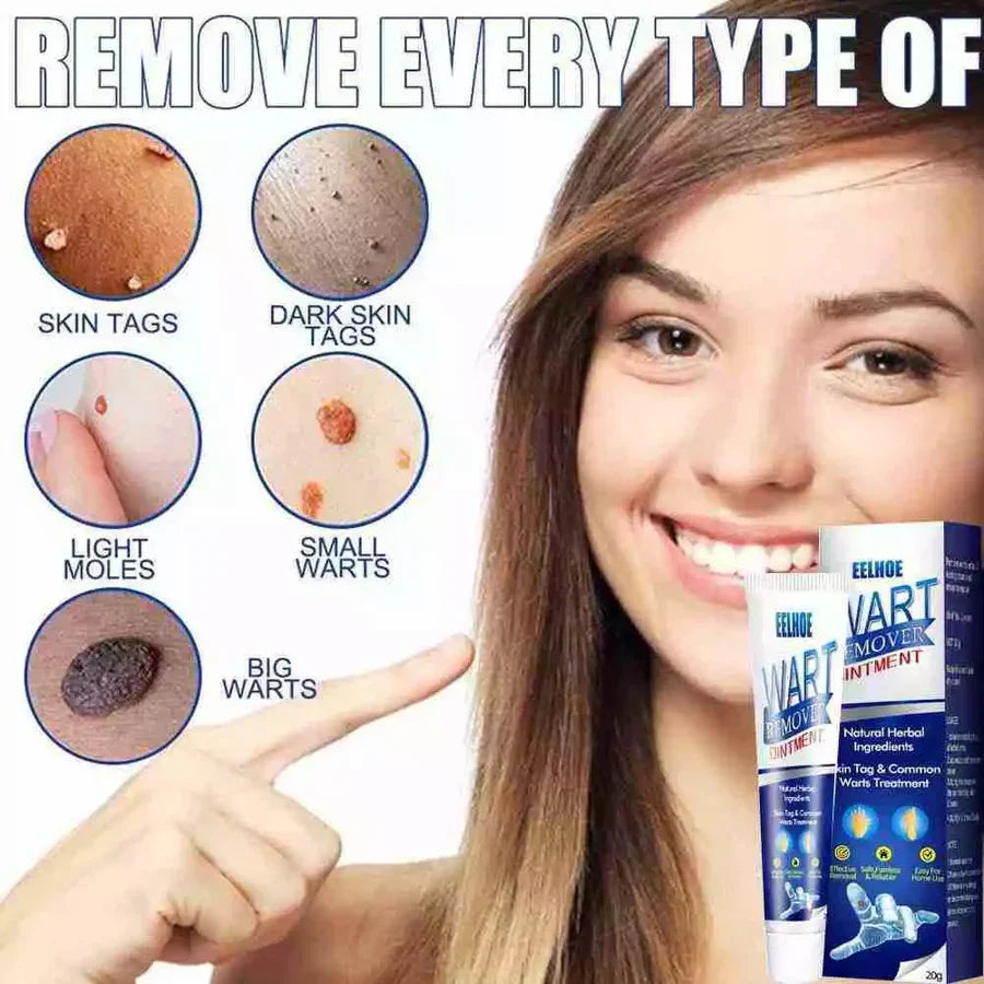 WartAway Herbal Cream