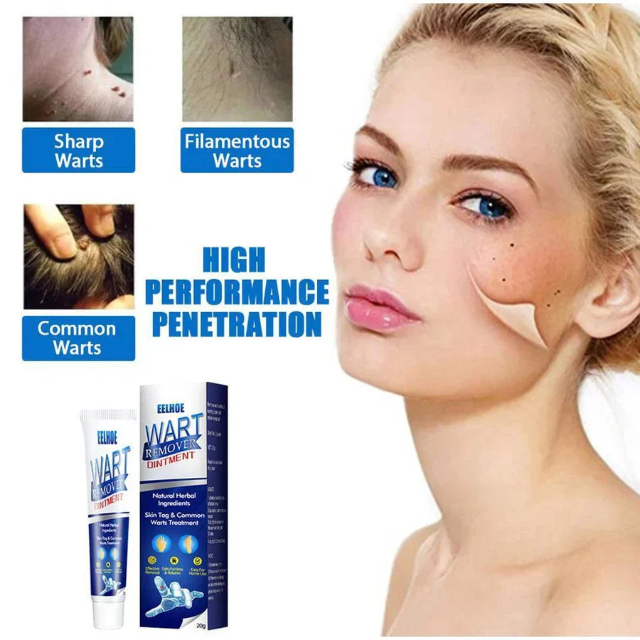 WartAway Herbal Cream